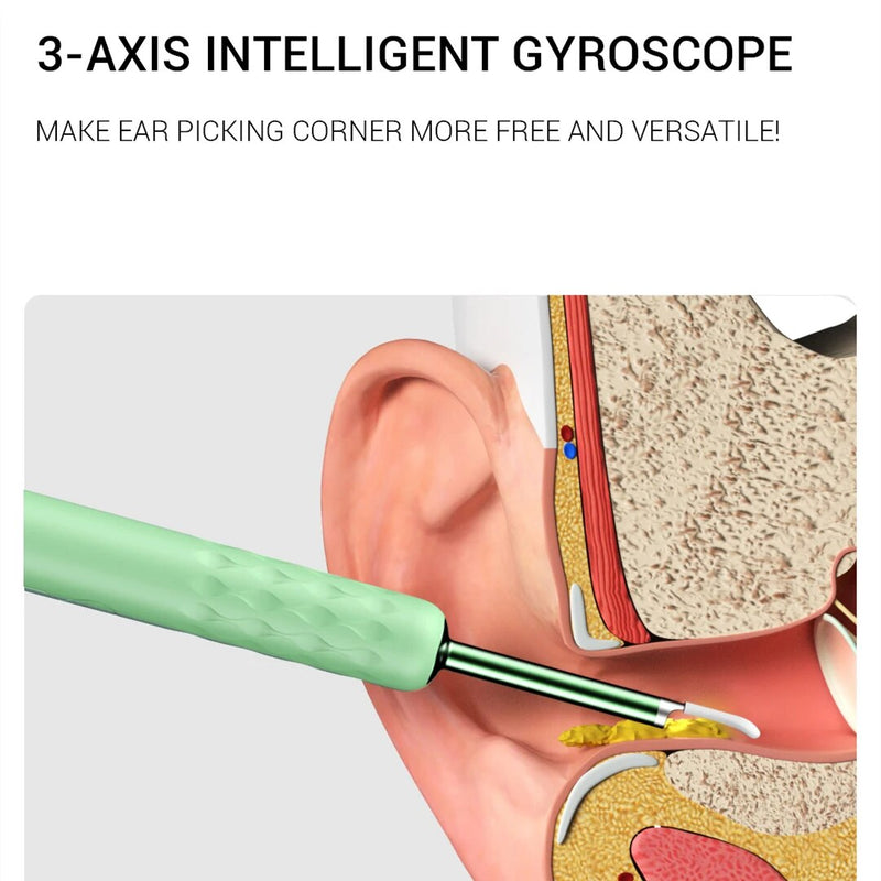 Bebird-R1 R3 X3 Smart Visual Ear Sticks endoscópio, Earpick de alta precisão, Mini câmera, otoscópio, cuidados de saúde, Mijia, 300W
